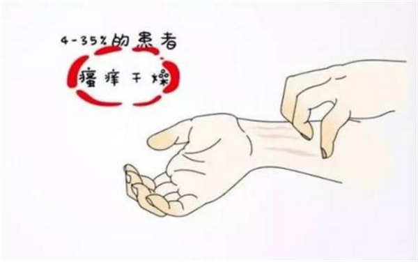 香蕉樹有什么用途 香蕉樹降低肝固醇治療高血壓