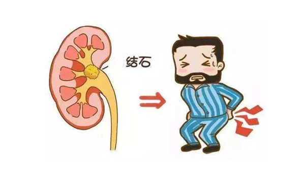 10類人千萬不能喝茶